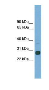 MXD1 / MAD antibody LS-C135047 Western blot of Mouse Spleen lysate.