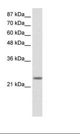 Transfected 293T Cell Lysate