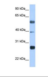 Transfected 293T cell lysate. Antibody concentration: 1.0 ug/ml. Gel concentration: 12%.