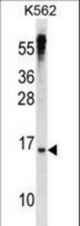 MXD3 Antibody western blot of K562 cell line lysates (35 ug/lane). The MXD3 antibody detected the MXD3 protein (arrow).