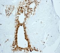 IHC of paraffin-embedded human breast tissue using anti-MAD3 antibody.