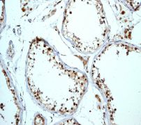 IHC of paraffin-embedded human testis tissue using anti-MAD3 antibody.