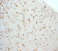 IHC of paraffin-embedded human brain tissue using anti-MAD3 antibody.