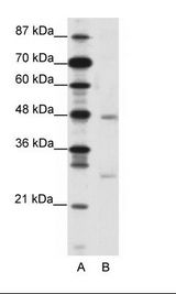 A: Marker, B: Jurkat Cell Lysate