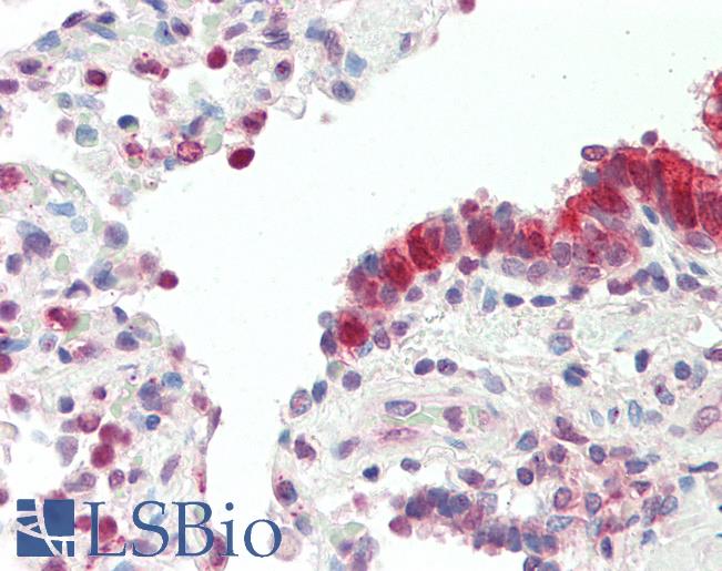 Human, Lung: Foramlin-Fixed Paraffin-Embedded (FFPE)