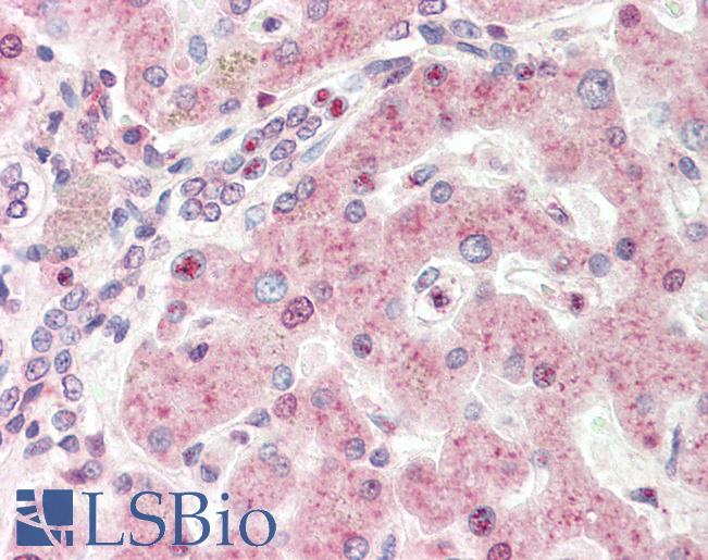 Human, Liver: Formalin-Fixed Paraffin-Embedded (FFPE)