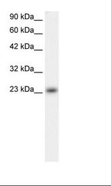 Fetal Heart Lysate