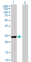 Western Blot analysis of MXI1 expression in transfected 293T cell line by MXI1 monoclonal antibody (M08), clone 1F3.Lane 1: MXI1 transfected lysate(26.1 KDa).Lane 2: Non-transfected lysate.