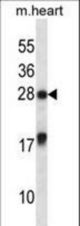 MXI1 Antibody western blot of mouse heart tissue lysates (35 ug/lane). The MXI1 antibody detected the MXI1 protein (arrow).