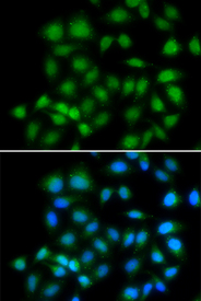 Immunofluorescence blot of HeLa cell using MXI1 antibody. Blue: DAPI for nuclear staining.