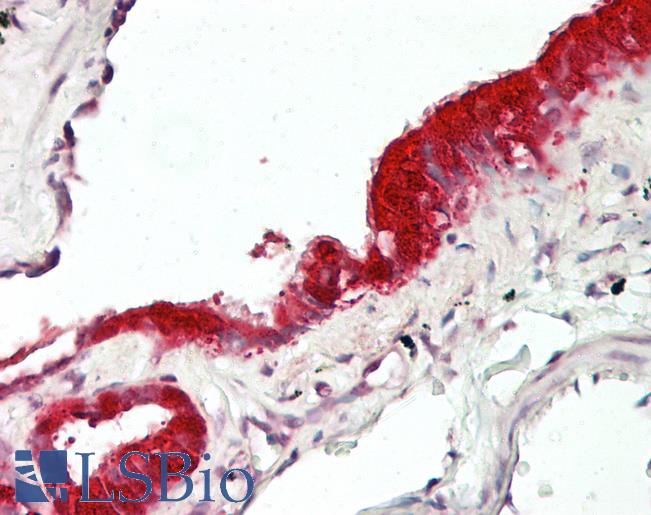 Anti-MXI1 / MAD2 antibody IHC of human lung, respiratory epithelium. Immunohistochemistry of formalin-fixed, paraffin-embedded tissue after heat-induced antigen retrieval. Antibody LS-B8041 dilution 5-7.5 ug/ml.