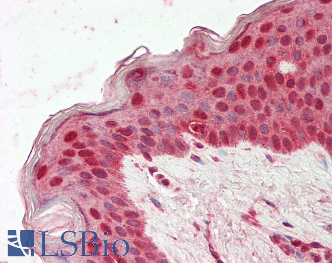 Human Skin: Formalin-Fixed, Paraffin-Embedded (FFPE)