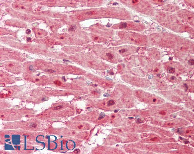 Human Heart: Formalin-Fixed, Paraffin-Embedded (FFPE)