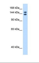 SP2/0 cell lysate. Antibody concentration: 0.25 ug/ml. Gel concentration: 8%.