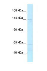 MYBBP1A antibody LS-C145970 Western blot of 3 Cell lysate. Antibody concentration 1 ug/ml.
