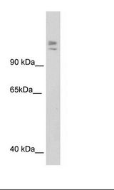 SP2/0 Cell Lysate