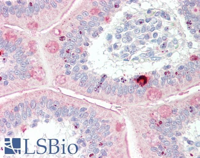 Anti-MYBL1 / A-MYB antibody IHC staining of human small intestine. Immunohistochemistry of formalin-fixed, paraffin-embedded tissue after heat-induced antigen retrieval. Antibody LS-B11121 concentration 10 ug/ml.