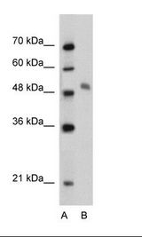 Jurkat Cell Lysate
