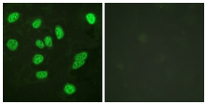 Immunofluorescence of HeLa cells, using B-Myb (Ab-577/581) Antibody. The picture on the right is treated with the synthesized peptide.