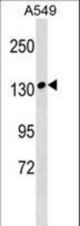 MYBPC1 Antibody western blot of A549 cell line lysates (35 ug/lane). The MYBPC1 antibody detected the MYBPC1 protein (arrow).