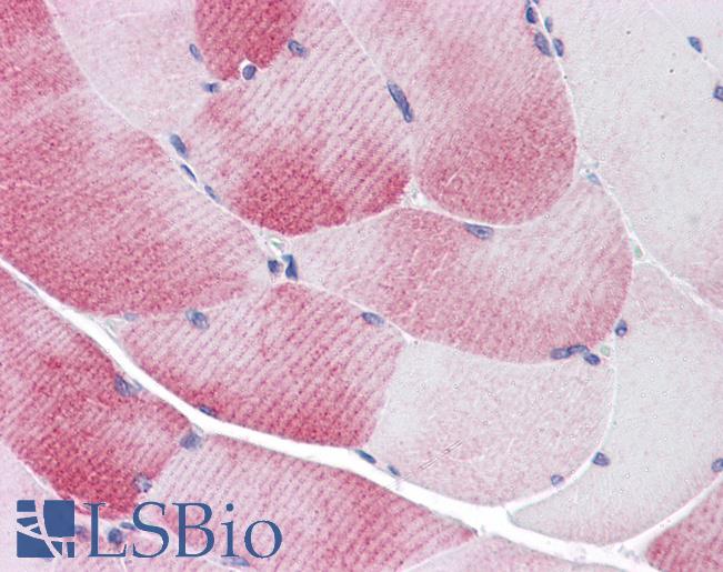 Anti-MYBPC1 antibody IHC of human skeletal muscle. Immunohistochemistry of formalin-fixed, paraffin-embedded tissue after heat-induced antigen retrieval. Antibody LS-B4725 concentration 5 ug/ml.