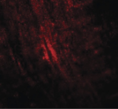 Immunofluorescence of MYBPC1 in mouse skeletal muscle cells with MYBPC1 antibody at 20 ug/ml.