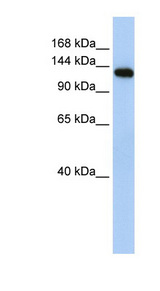 MYBPC2 antibody LS-C101947 Western blot of Fetal Muscle lysate.