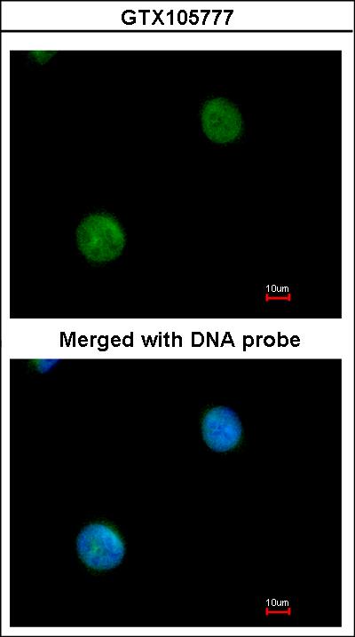 Immunofluorescence of paraformaldehyde-fixed HeLa using MYBPC2 antibody at 1:200 dilution.