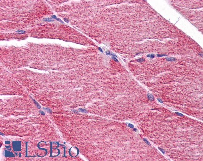 Anti-MYBPC2 antibody IHC of human skeletal muscle. Immunohistochemistry of formalin-fixed, paraffin-embedded tissue after heat-induced antigen retrieval. Antibody LS-B5081 concentration 5 ug/ml.