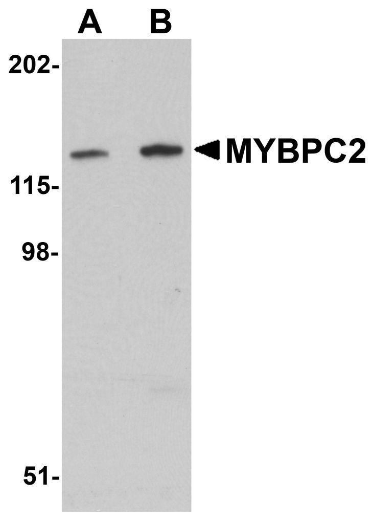 Western blot analysis of MYBPC2 in mouse skeletal muscle tissue lysate with MYBPC2 antibody at (A) 1 and (B) 2 ug/ml.