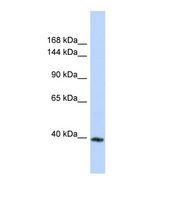 Western blot of Human MCF7. MYBPC3 antibody dilution 1.0 ug/ml.
