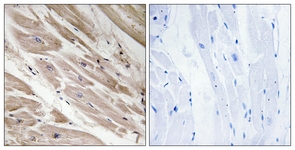 IHC of paraffin-embedded human heart tissue, using MYBPC3 Antibody. The picture on the right is treated with the synthesized peptide.