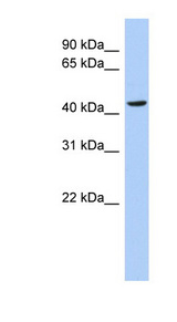 MYC / c-Myc antibody LS-C109559 Western blot of HT1080 cell lysate.