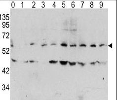 Western blot of Phospho-MYC-T58 Antibody in human TPA activated HeLa cell line lysates. Phospho-MYC (arrow) was detected using the purified antibody. (0: without TPA; 1: 60 ug/ml TPA, 15min; 2: 60 ug/ml TPA, 30min; 3: 60 ug/ml TPA, 45min; 4: 125 ug/ml TPA, 15min; 5: 125 ug/ml TPA, 30min; 6: 125 ug/ml TPA, 45min; 7: 250 ug/ml TPA, 15min; 8: 250 ug/ml TPA, 30min; 9: 250 ug/ml, 45min)