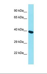 Western blot of Human Thyroid Tumor. MCM7 antibody dilution 1.0 ug/ml.