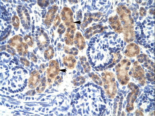 MYCBP antibody LS-C30555 was used in IHC to stain formalin-fixed, paraffin-embedded human kidney.