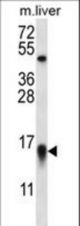MYCBP Antibody western blot of mouse liver tissue lysates (35 ug/lane). The MYCBP antibody detected the MYCBP protein (arrow).