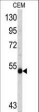 Western blot of MYCN antibody in CEM cell line lysates (35 ug/lane). MYCN (arrow) was detected using the purified antibody.