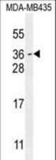 MYCT1 Antibody western blot of MDA-MB435 cell line lysates (35 ug/lane). The MYCT1 antibody detected the MYCT1 protein (arrow).