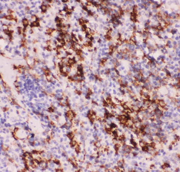 MyD88 antibody IHC-paraffin: Mouse Spleen Tissue.