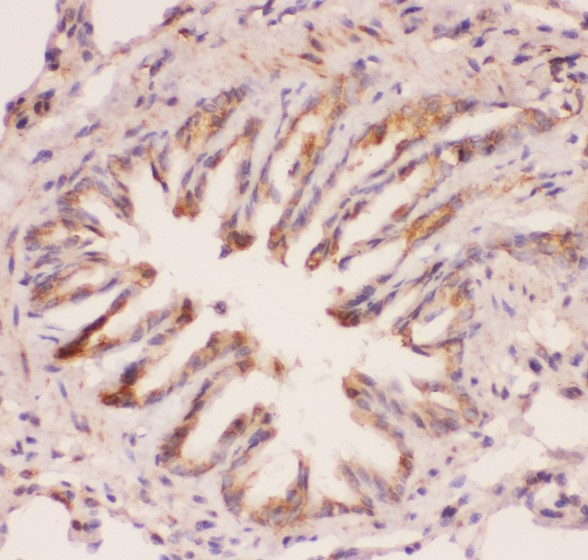 MyD88 antibody IHC-paraffin: Rat Lung Tissue.