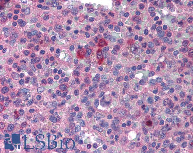 Anti-MYD88 antibody IHC of human spleen. Immunohistochemistry of formalin-fixed, paraffin-embedded tissue after heat-induced antigen retrieval. Antibody LS-B1379 concentration 2 ug/ml.