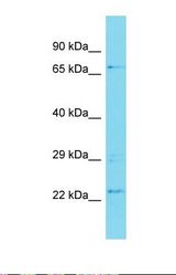 Western blot of 721_B. METTL21C antibody dilution 1.0 ug/ml.