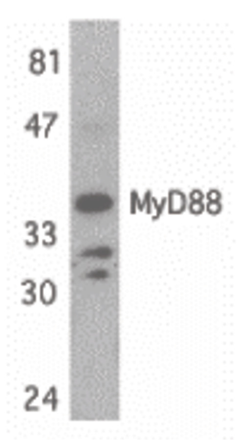 Western blot of MyD88 in Jurkat whole cell lysate with MyD88 antibody at 1 ug/ml.