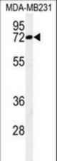 Western blot of CJ119 Antibody in MDA-MB231 cell line lysates (35 ug/lane). CJ119 (arrow) was detected using the purified antibody.
