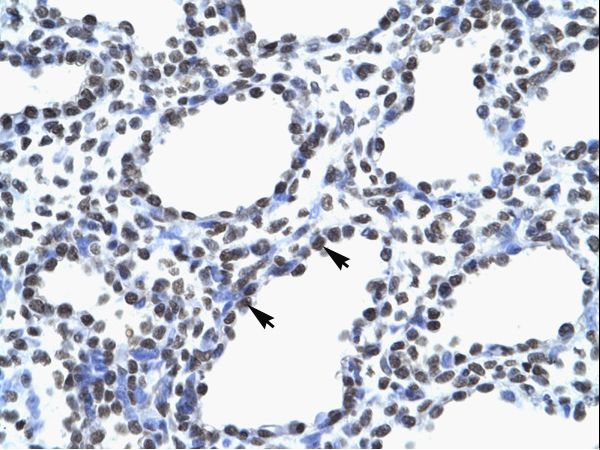 MYEF2 antibody LS-C29791 was used in IHC to stain formalin-fixed, paraffin-embedded human lung.