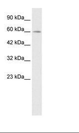 Jurkat Cell Lysate