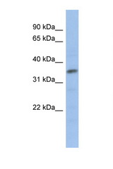 MYF5 antibody LS-C29704 Western blot of Jurkat Cell lysate. Antibody concentration 1 ug/ml.