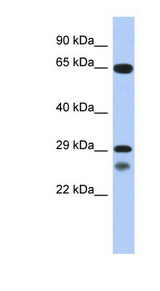 MYF5 antibody LS-C109586 Western blot of Placenta lysate.
