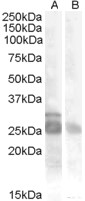 Antibody (0.5 ug/ml) staining of Muscle lysate (35 ug protein in RIPA buffer) with (B) and without (A) blocking with the immunizing peptide. Primary incubation was 1 hour. Detected by chemiluminescence.